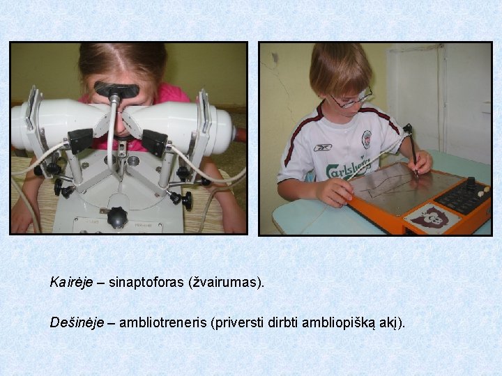 Kairėje – sinaptoforas (žvairumas). Dešinėje – ambliotreneris (priversti dirbti ambliopišką akį). 