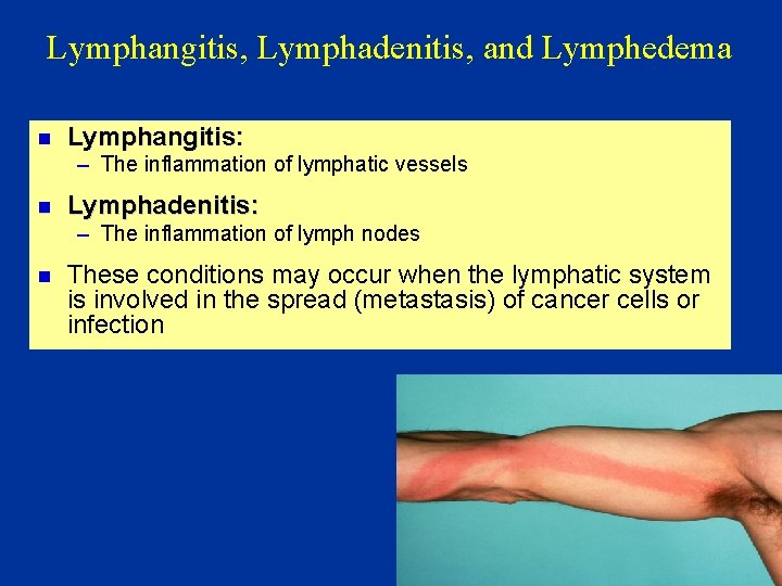 Lymphangitis, Lymphadenitis, and Lymphedema n Lymphangitis: – The inflammation of lymphatic vessels n Lymphadenitis: