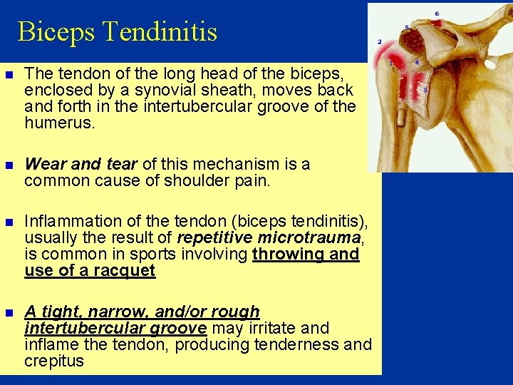 Biceps Tendinitis n The tendon of the long head of the biceps, enclosed by
