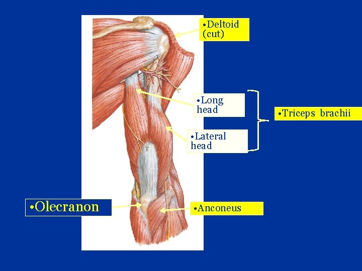  • Deltoid (cut) • Long head • Lateral head • Olecranon • Anconeus