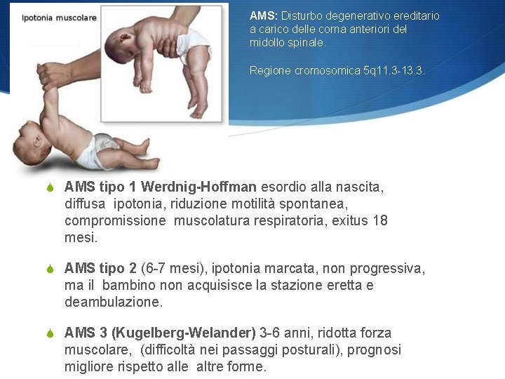 AMS: Disturbo degenerativo ereditario a carico delle corna anteriori del midollo spinale. Regione cromosomica