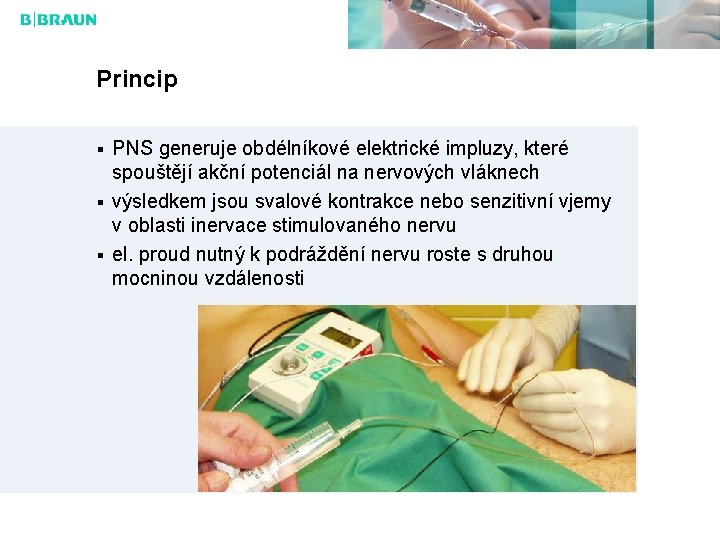 Princip PNS generuje obdélníkové elektrické impluzy, které spouštějí akční potenciál na nervových vláknech výsledkem