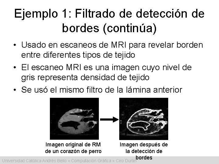 Ejemplo 1: Filtrado de detección de bordes (continúa) • Usado en escaneos de MRI