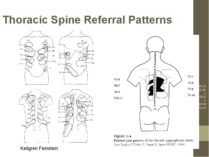 Thoracic Spine Referral Patterns Manual Therap y Institut e Internat ional Kellgren Feinstein 