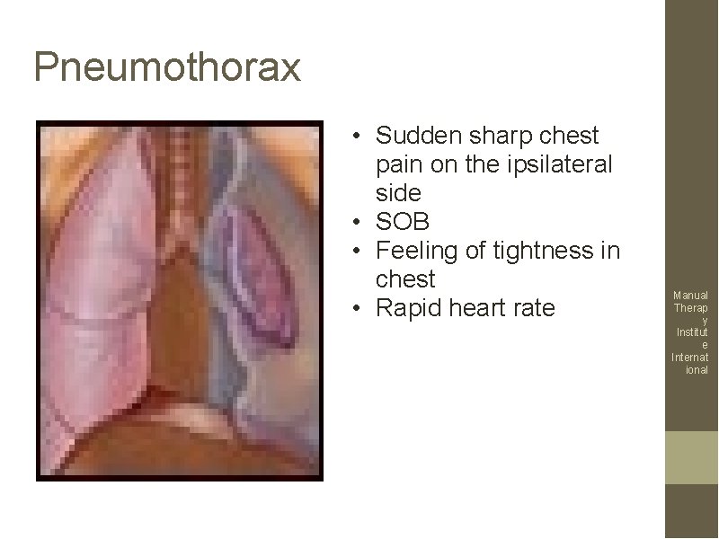 Pneumothorax • Sudden sharp chest pain on the ipsilateral side • SOB • Feeling