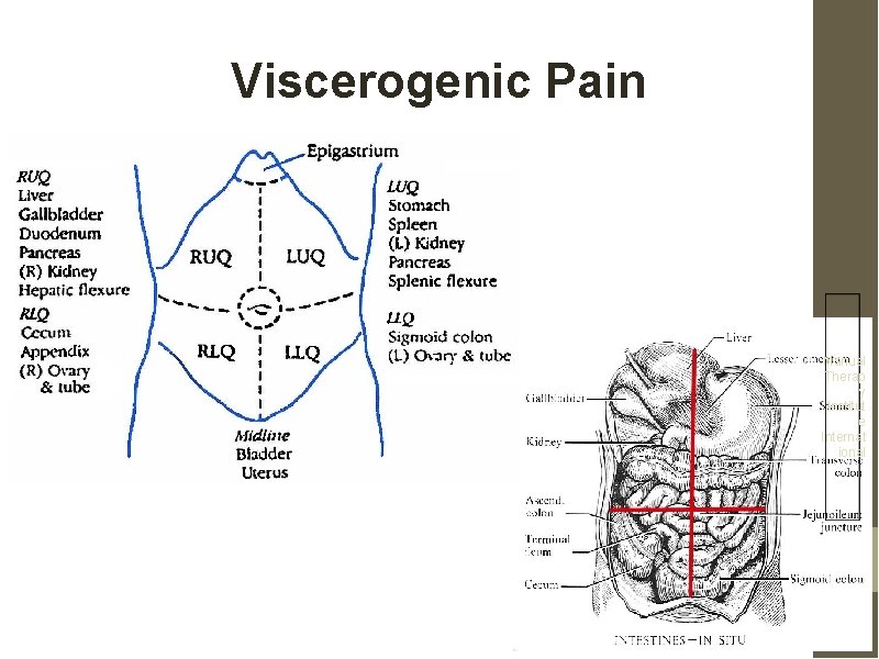 Viscerogenic Pain Manual Therap y Institut e Internat ional 
