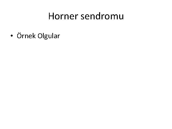 Horner sendromu • Örnek Olgular 