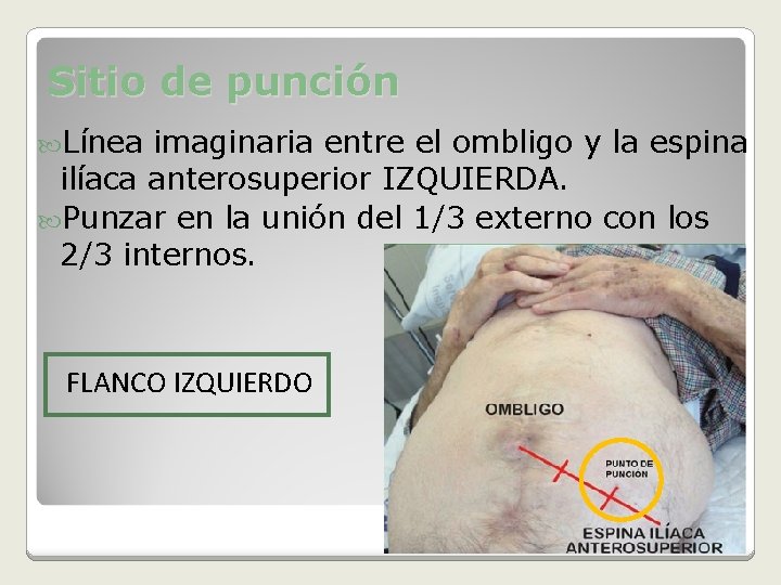 Sitio de punción Línea imaginaria entre el ombligo y la espina ilíaca anterosuperior IZQUIERDA.