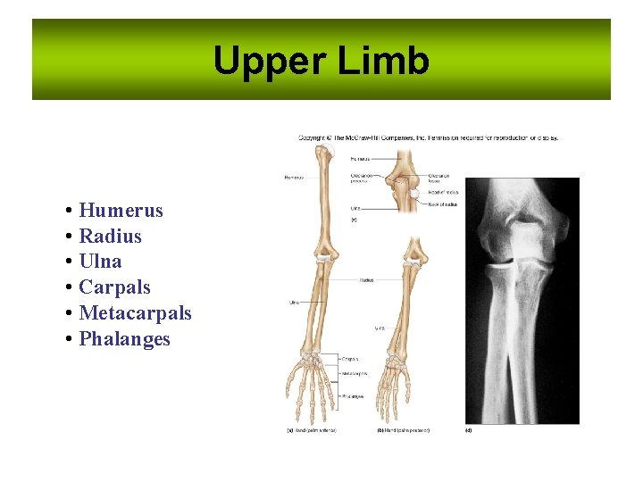 Upper Limb • Humerus • Radius • Ulna • Carpals • Metacarpals • Phalanges