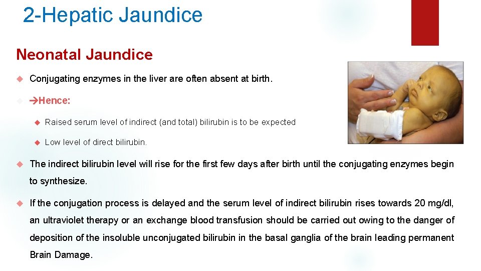 2 -Hepatic Jaundice Neonatal Jaundice Conjugating enzymes in the liver are often absent at