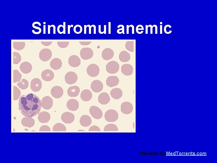 Sindromul anemic Release by Med. Torrents. com 