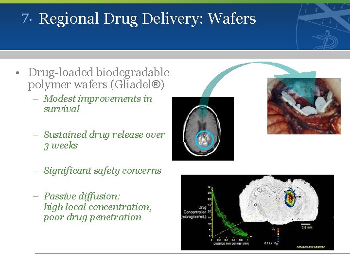 7. Regional Drug Delivery: Wafers • Drug-loaded biodegradable polymer wafers (Gliadel®) – Modest improvements