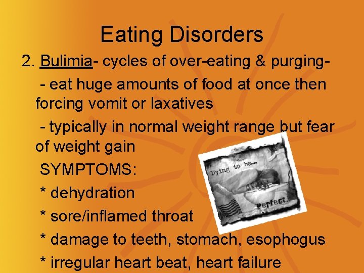 Eating Disorders 2. Bulimia- cycles of over-eating & purging- eat huge amounts of food