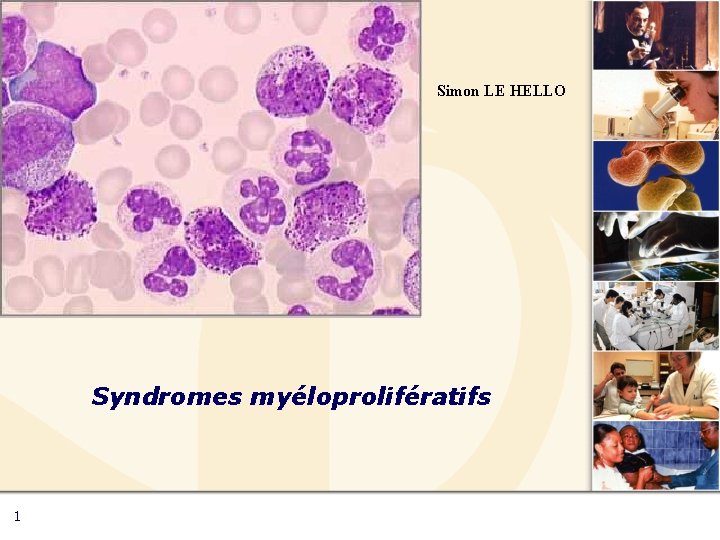 Simon LE HELLO Syndromes myéloprolifératifs 1 