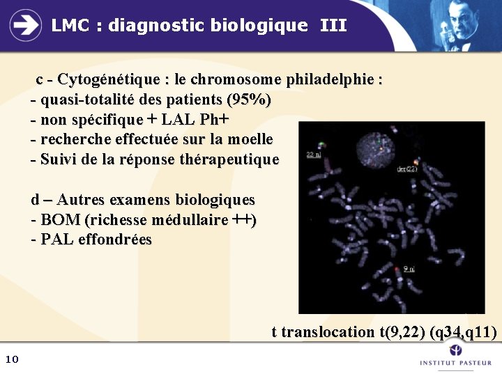 LMC : diagnostic biologique III c - Cytogénétique : le chromosome philadelphie : -