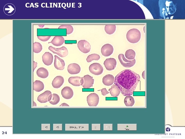 CAS CLINIQUE 3 24 