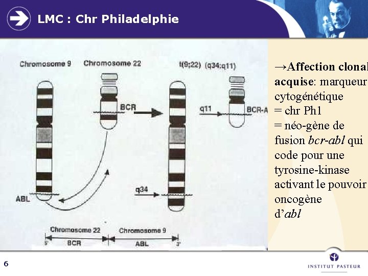 LMC : Chr Philadelphie →Affection clonal acquise: marqueur cytogénétique = chr Ph 1 =