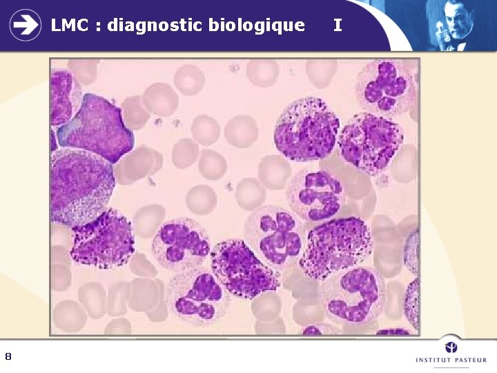 LMC : diagnostic biologique 8 I 