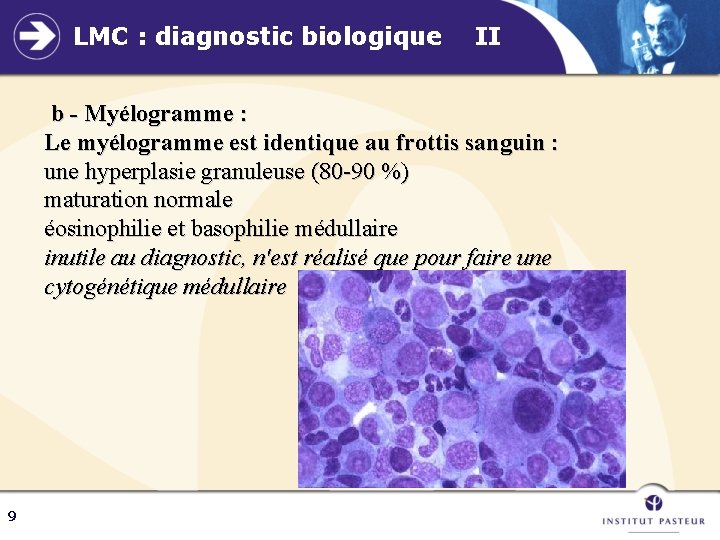 LMC : diagnostic biologique II b - Myélogramme : Le myélogramme est identique au