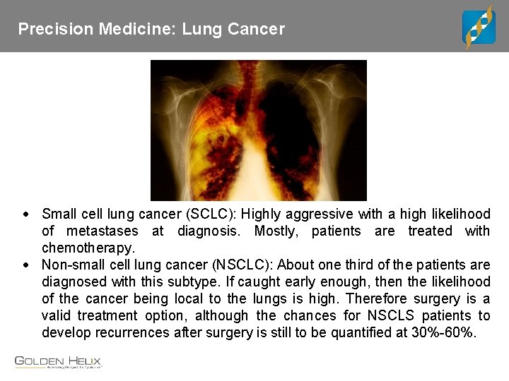 Precision Medicine: Lung Cancer Small cell lung cancer (SCLC): Highly aggressive with a high