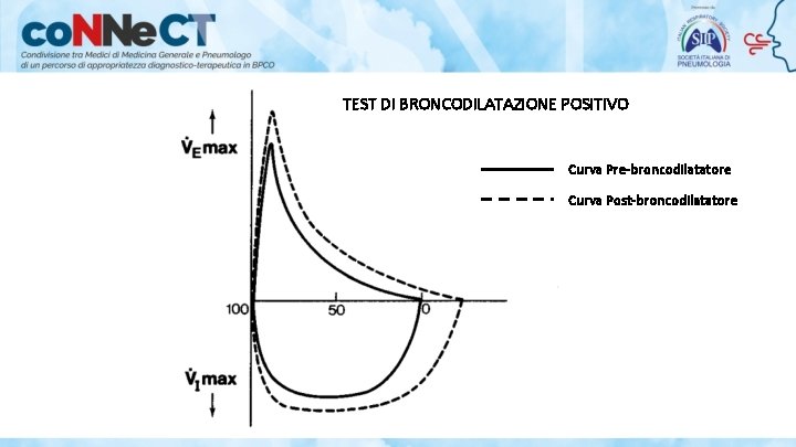 TEST DI BRONCODILATAZIONE POSITIVO Curva Pre-broncodilatatore Curva Post-broncodilatatore 