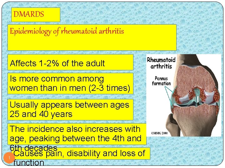 DMARDS Epidemiology of rheumatoid arthritis Affects 1 -2% of the adult population Is more