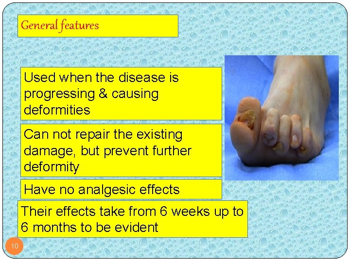General features Used when the disease is progressing & causing deformities Can not repair