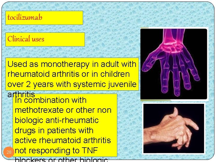 tocilizumab Clinical uses Used as monotherapy in adult with rheumatoid arthritis or in children