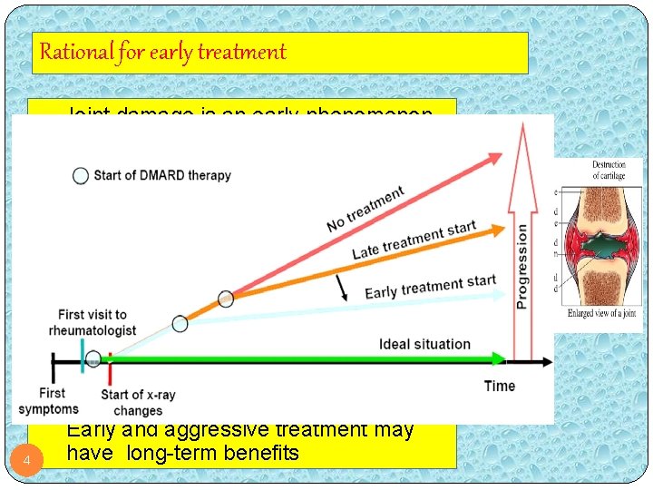 Rational for early treatment Joint damage is an early phenomenon of rheumatoid arthritis Joint