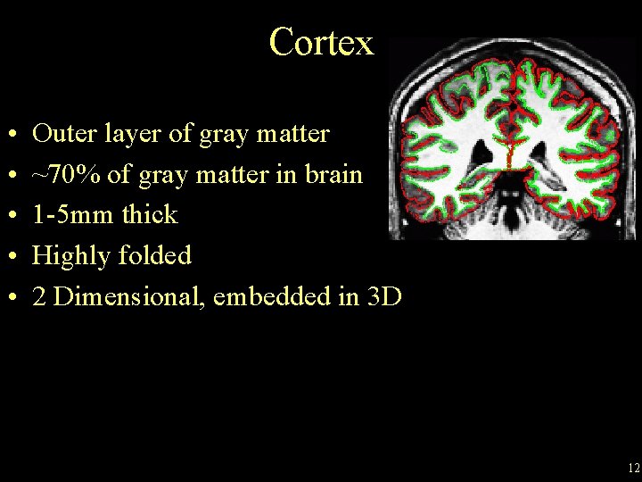 Cortex • • • Outer layer of gray matter ~70% of gray matter in