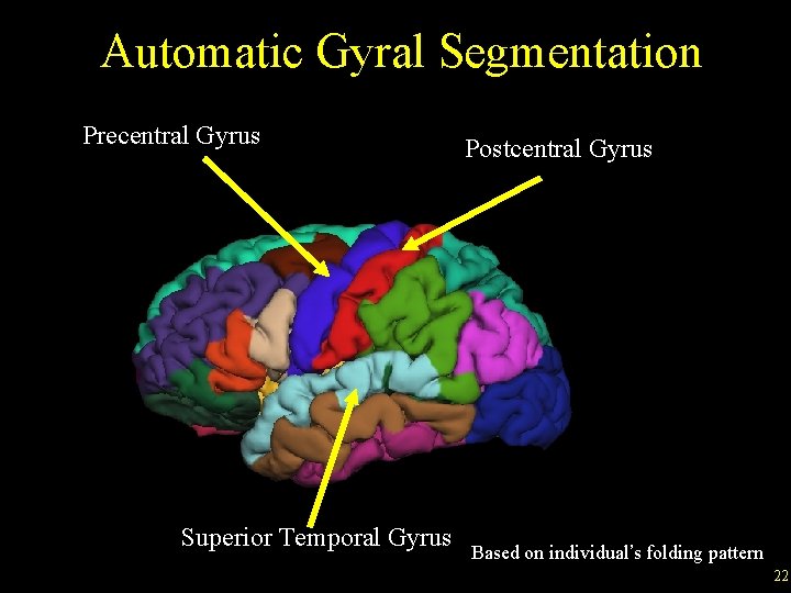 Automatic Gyral Segmentation Precentral Gyrus Superior Temporal Gyrus Postcentral Gyrus Based on individual’s folding