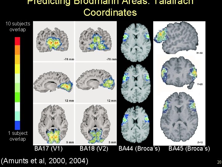 Predicting Brodmann Areas: Talairach Coordinates 10 subjects overlap 1 subject overlap BA 17 (V