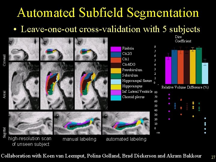 Automated Subfield Segmentation • Leave-one-out cross-validation with 5 subjects Dice Coefficient Fimbria CA 2/3