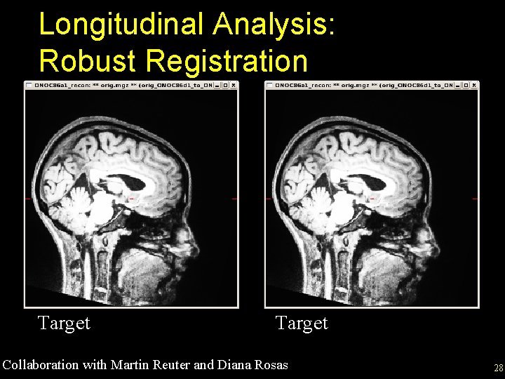 Longitudinal Analysis: Robust Registration Target Collaboration with Martin Reuter and Diana Rosas 28 