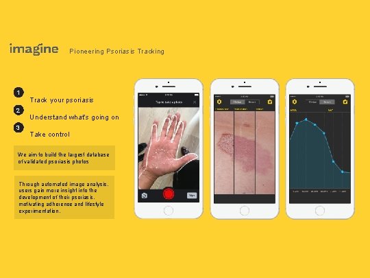 Pioneering Psoriasis Tracking 1 2 3 Track your psoriasis Understand what’s going on Take