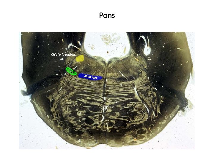 Pons Chief trig nucleus ALS Med lem 