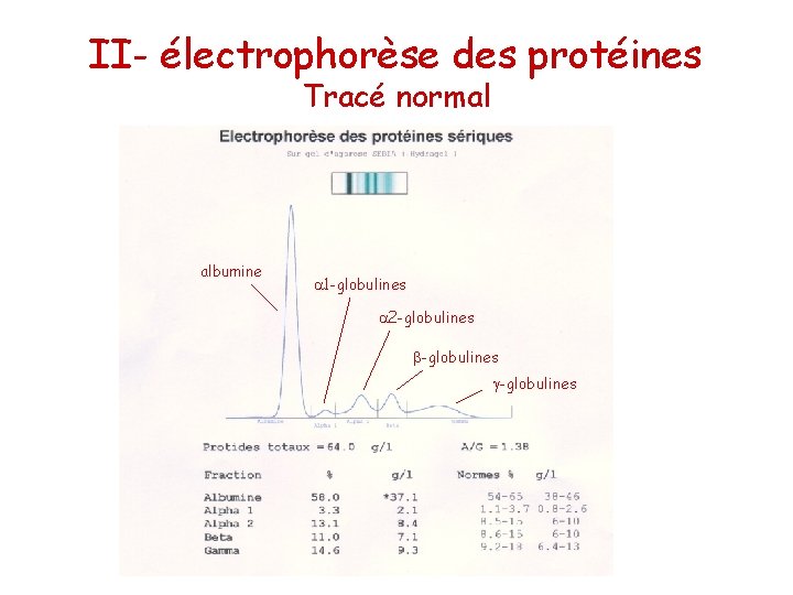 II- électrophorèse des protéines Tracé normal albumine 1 -globulines 2 -globulines 