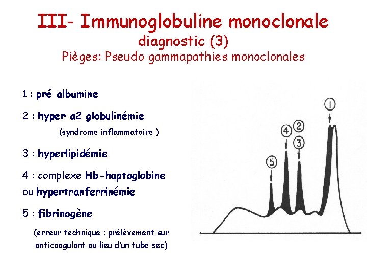 III- Immunoglobuline monoclonale diagnostic (3) Pièges: Pseudo gammapathies monoclonales 1 : pré albumine 2