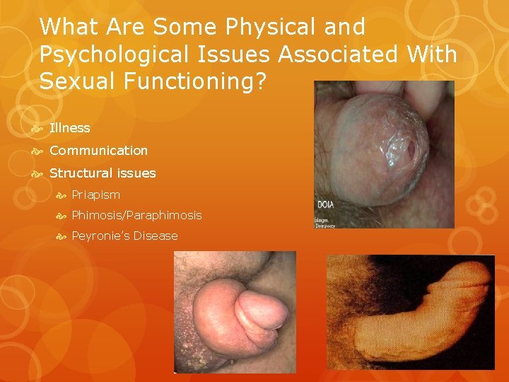 What Are Some Physical and Psychological Issues Associated With Sexual Functioning? Illness Communication Structural