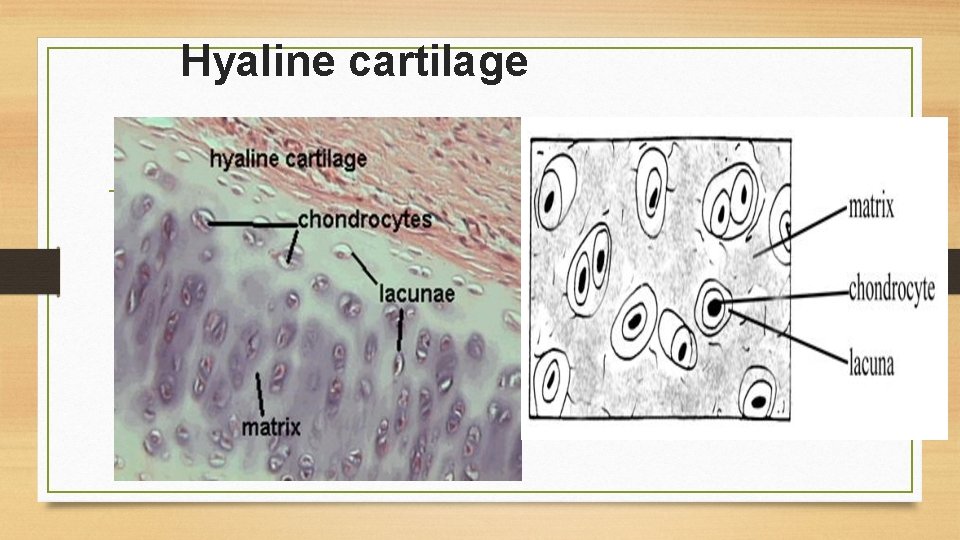 Hyaline cartilage 