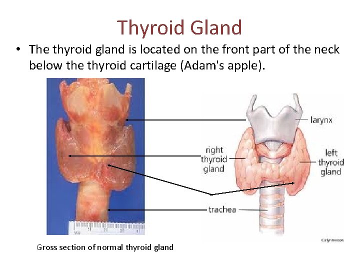 Thyroid Gland • The thyroid gland is located on the front part of the