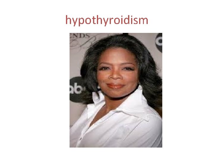 hypothyroidism 