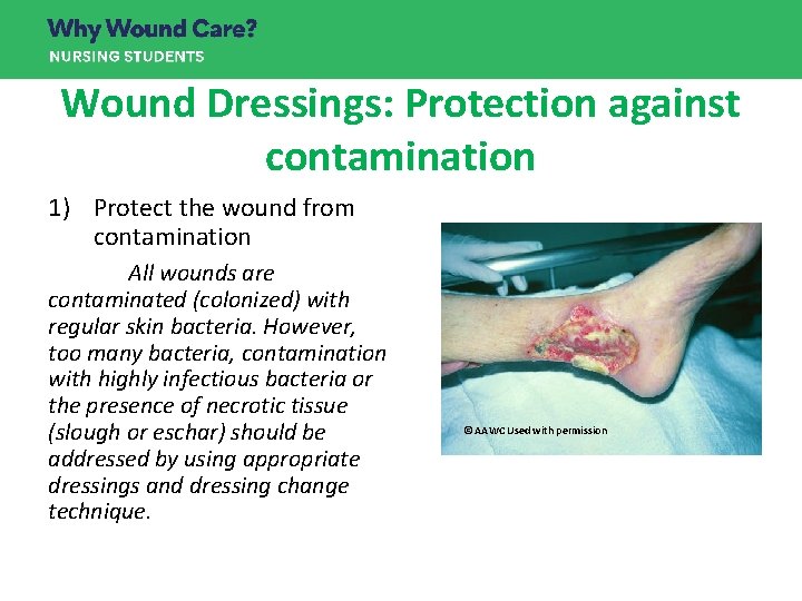 Wound Dressings: Protection against contamination 1) Protect the wound from contamination All wounds are