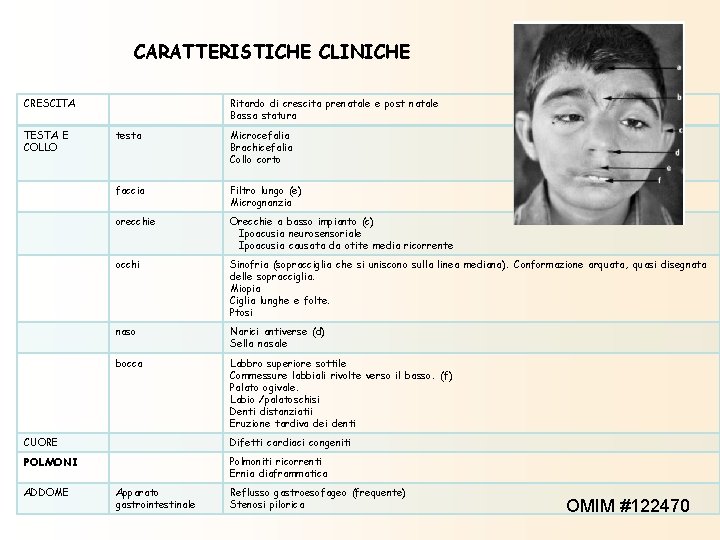 CARATTERISTICHE CLINICHE CRESCITA TESTA E COLLO Ritardo di crescita prenatale e post natale Bassa CARATTERISTICHE CLINICHE CRESCITA TESTA E COLLO Ritardo di crescita prenatale e post natale Bassa