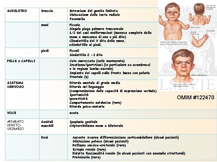 SCHELETRO braccia Estensione del gomito limitata Dislocazione della testa radiale Focomelia mani Piccole. Singola SCHELETRO braccia Estensione del gomito limitata Dislocazione della testa radiale Focomelia mani Piccole. Singola