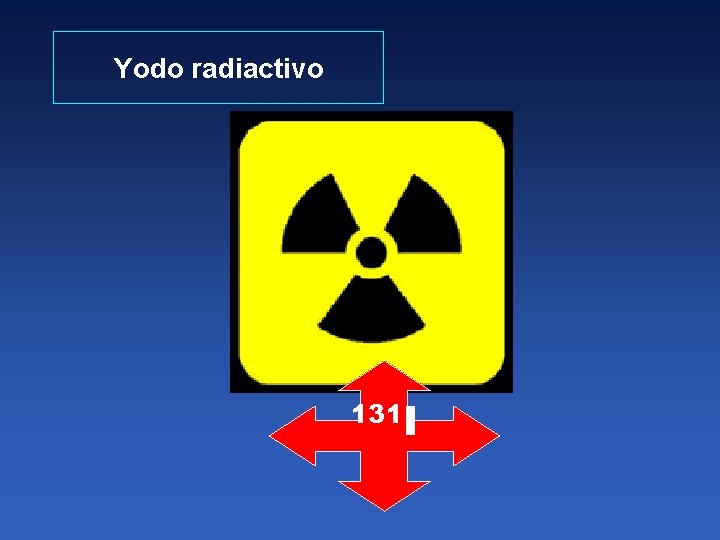 Yodo radiactivo 131 I 