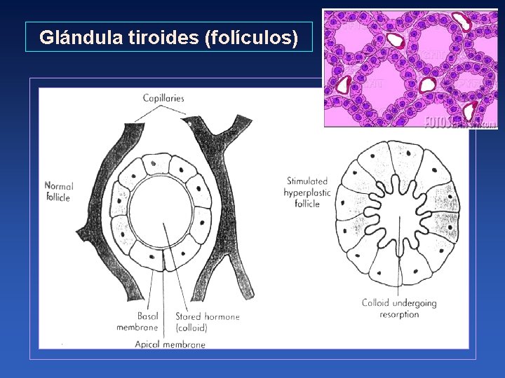 Glándula tiroides (folículos) 