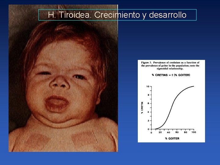 H. Tiroidea. Crecimiento y desarrollo 