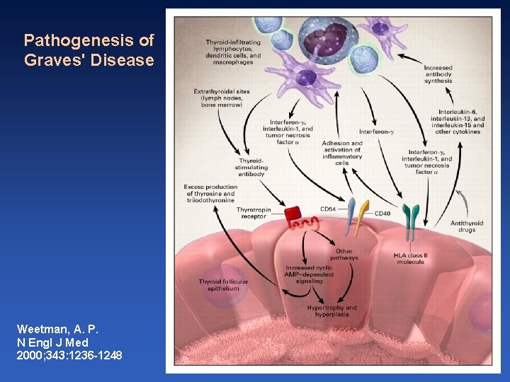 Pathogenesis of Graves' Disease Weetman, A. P. N Engl J Med 2000; 343: 1236