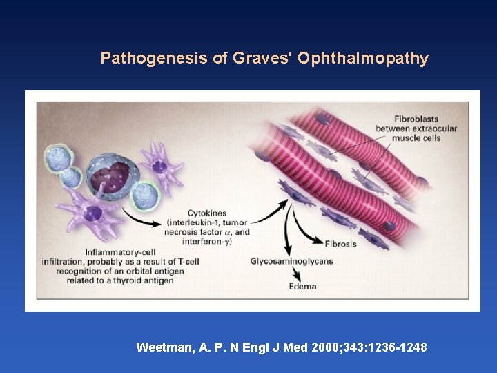 Pathogenesis of Graves' Ophthalmopathy Weetman, A. P. N Engl J Med 2000; 343: 1236